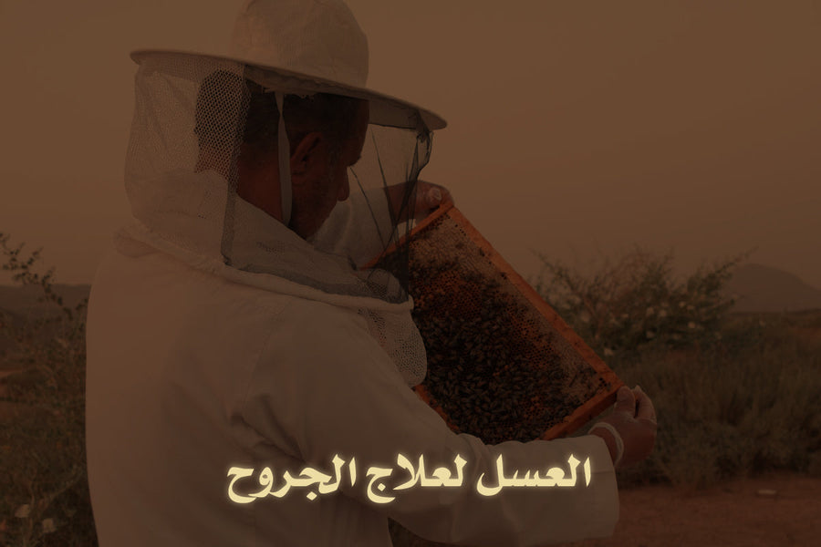 العسل لعلاج الجروح