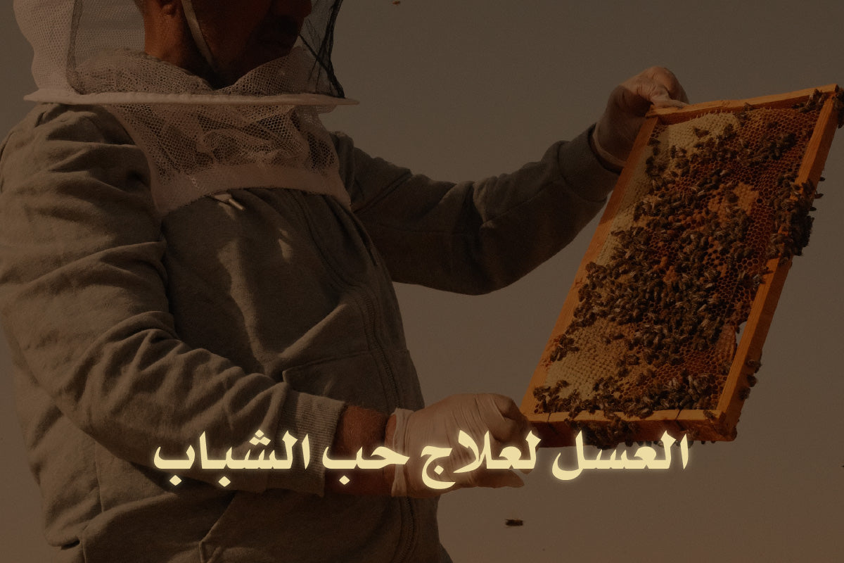 العسل لعلاج حب الشباب