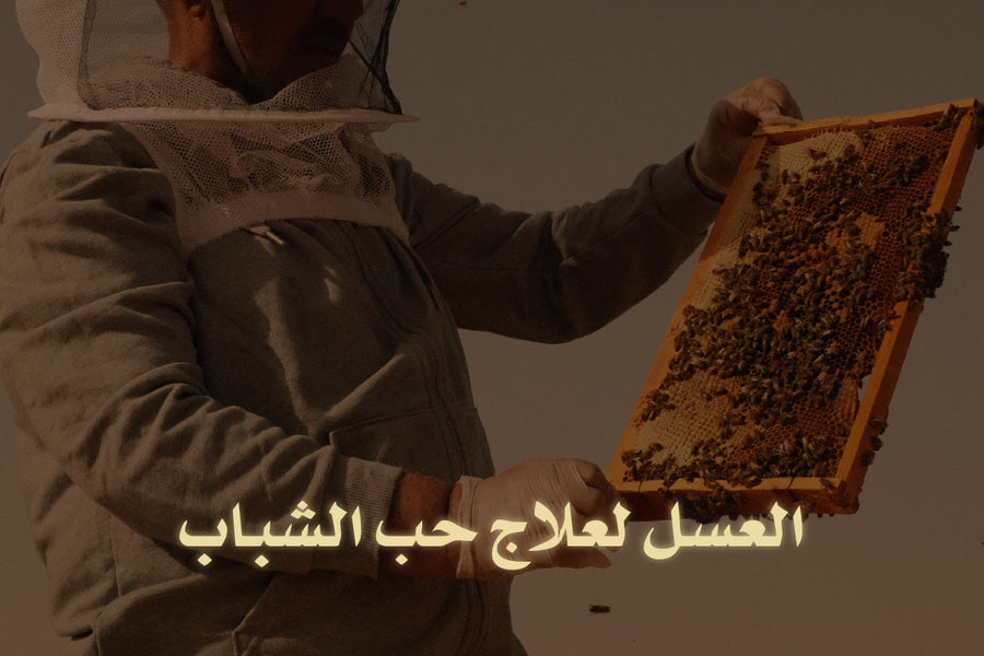 العسل لعلاج حب الشباب